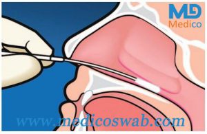 Nasal swab