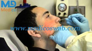 Swab nasal pode ajudar a diagnosticar câncer de pulmão