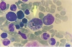 Détection quantitative de virus et de maladies bactériennes par Q-PCR à l'aide des écouvillons d'échantillons de Medico