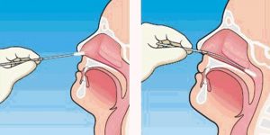 Nasal swab sample collection