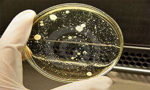 Medico microbiological sampling swab