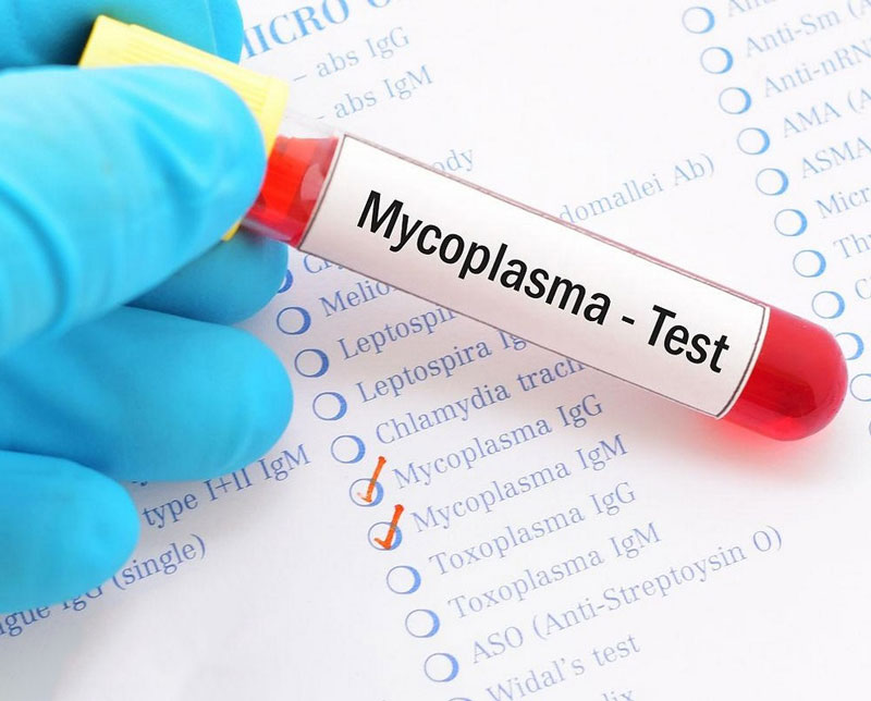 Infection à Mycoplasma pneumoniae: Symptômes, Transmission, et ...