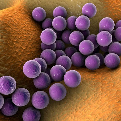 Comprendre Staphylococcus aureus: Une infection bactérienne ...